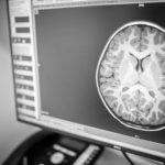 brain scan on computer screen