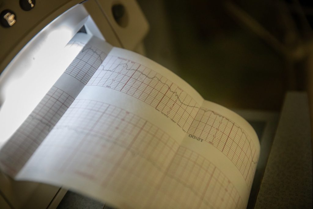 A paper print out of labour contractions and heart rate lines