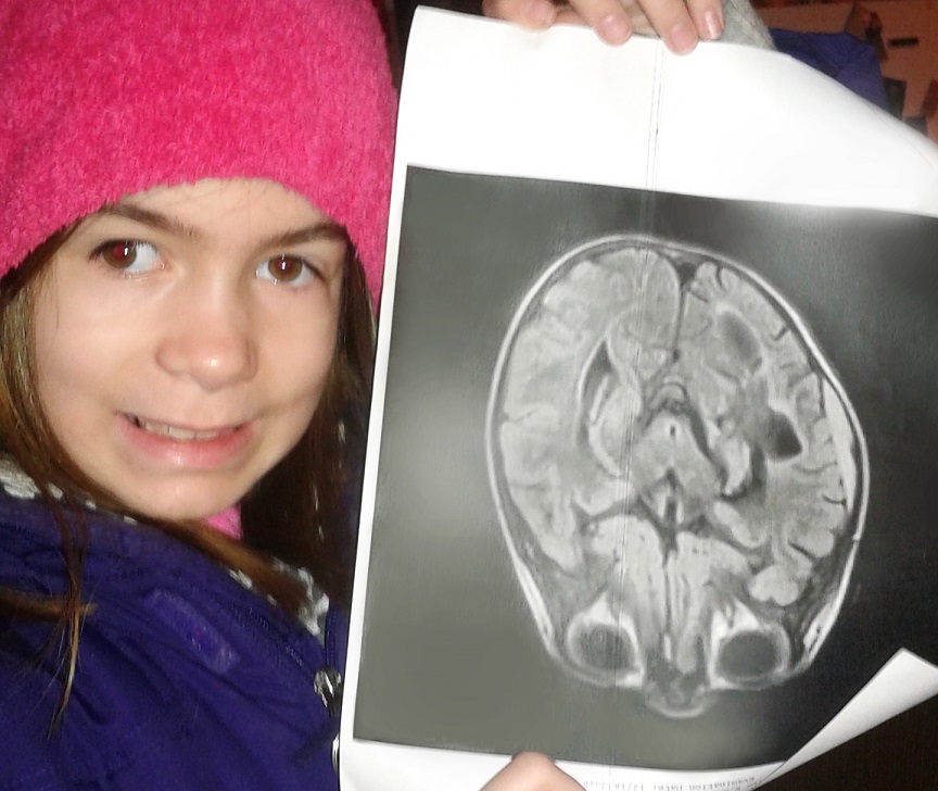 Abby holding a scan of her brain.
