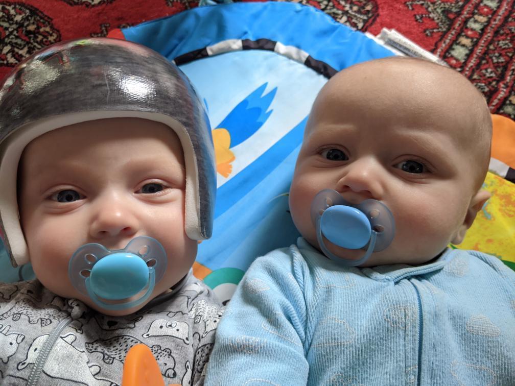 Calvin McKay, wearing the helmet developed at Ron Joyce Children's Health Centre, beside his twin brother Pierce.