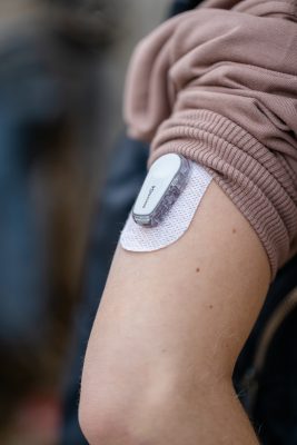 The continuous glucose monitoring sensor worn on the arm to track levels,