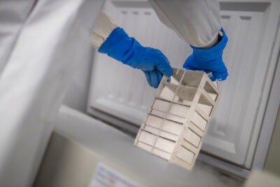 A researcher wearing blue gloves stores AML samples in a special freeser